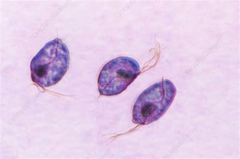 Trichomoniasis Pictures Under Microscope