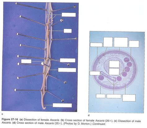 Two Diagrams Dissection Of A Male Ascaris And Cross Section Of