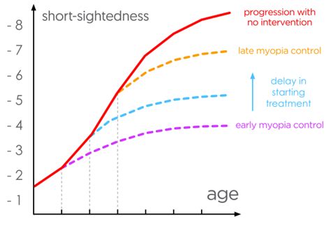 Myopia Control Reduce Myopia Progression Optometrist Melbourne