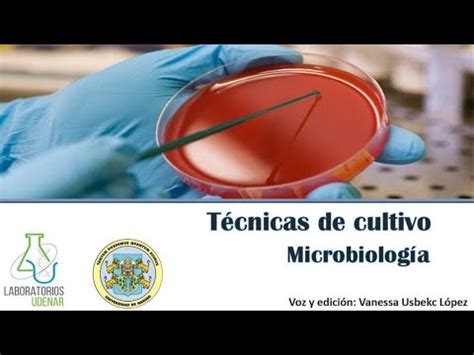 T Cnicas De Siembra Segunda Parte Microbiolog A Youtube