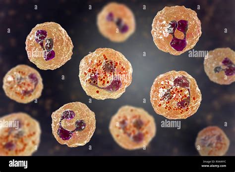 Meningite Meningococcica Immagini E Fotografie Stock Ad Alta