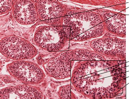 Anatomy Physiology II Lab Final Exam Testis Histology Diagram