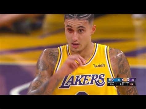 Kyle Kuzma Suffers EXTREMELY BLOODY EYE Vs Thunder FULL Video YouTube