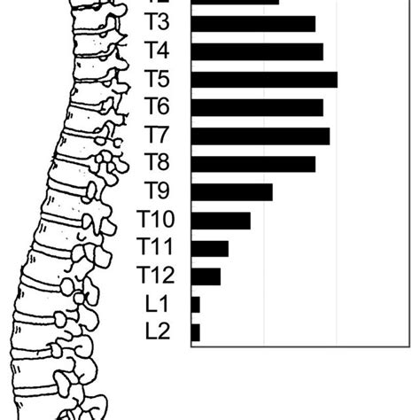 Distribution Of Thoracic Ossification Of Posterior Longitudinal