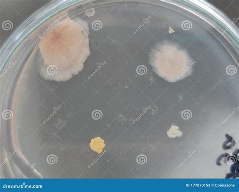 Bacillus And Other Bacteria And Fungi Growing On Nutrient Agar Medium