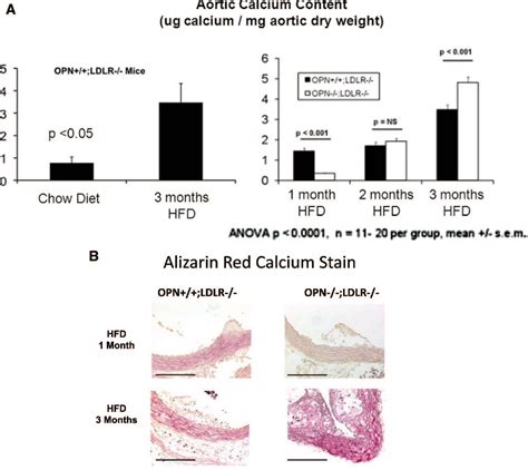 Figure From Vascular Calcification And Aortic Fibrosis A