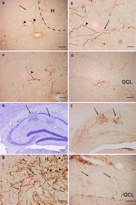 Photomicrographs Of Coronal Sections From The Dorsal Hippocampus Of