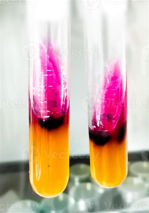 Salmonella Detection Method By Using Triple Sugar Iron Or Tsi Agar In