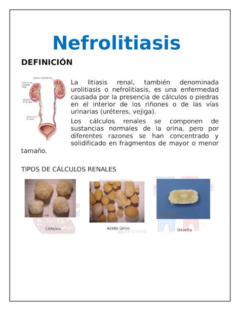 DOCX Nefrolitiasis Word Docx DOKUMEN TIPS