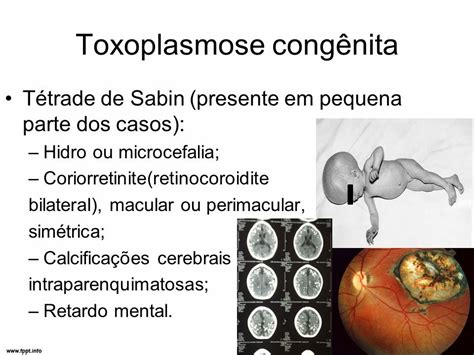 Active Sa De Toxoplasmose A Culpa Sua Ou Do Gato