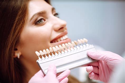 Cosa Sono Le Faccette Dentali Estetiche E Quanto Costano