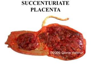 Placenta abnormalities | PPT