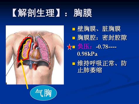 胸部疾病病人的护理word文档在线阅读与下载无忧文档