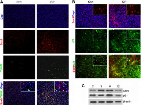 Cp Treatment Induces Sox Expression Which Co Localizes In Cells