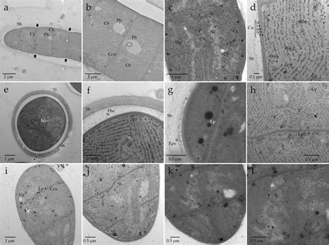 Transmission Electron Microscopy TEM Micrographs Of The Cell