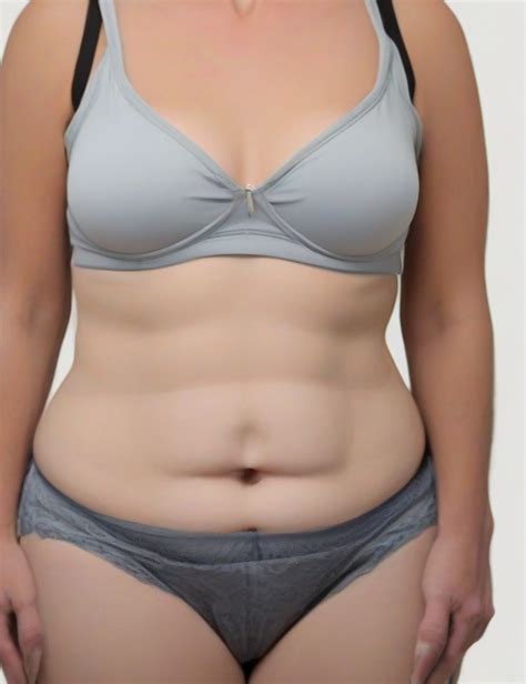 11 Tummy Tuck Tips For Success And Lower Costs Booboone