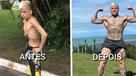 Mc Pedrinho Antes E Depois Youtube