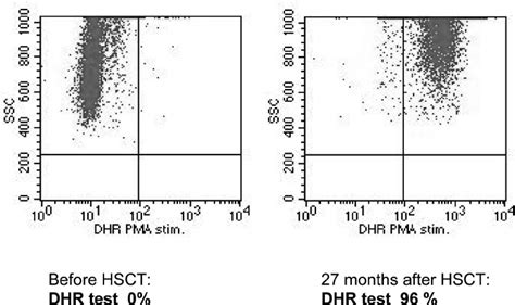 Dihydrorhodamine Test After Stimulation With Phorbol 12 Myristate