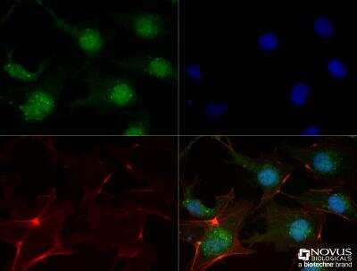 FGFR1 Antibody M2F12 BSA Free NB120 829 By Novus Part Of Bio Techne