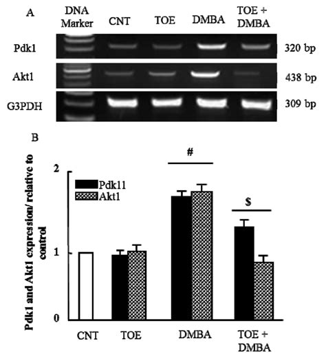 A Semi Quantitative Rt Pcr Analysis Of Pdk1 And Map3k1 Mrna