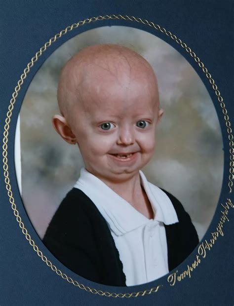 Hayley Okines: Emotional tributes to inspirational teen who 'changed