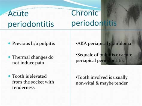 Management Of Apical Lesions