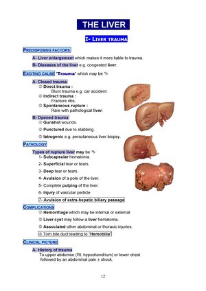 Biliary System Medicine Way Gall Stones Chronic