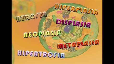 Atrofia hiperplasia metaplasia cambios en células y tejidos YouTube