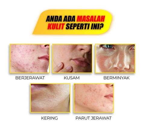 Naiskin Vitamin Untuk Kulit Cantik