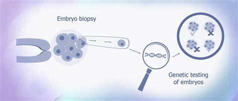 Pgd Vs Pgs Australian Concept Infertility Medical Center