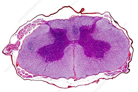 Spinal Cord Transverse Section Stock Image C001 0793 Science