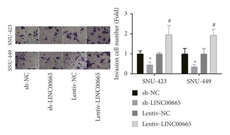 Linc00665 Enhanced Hcc Viability And Aerobic Glycolysis A The Download Scientific Diagram