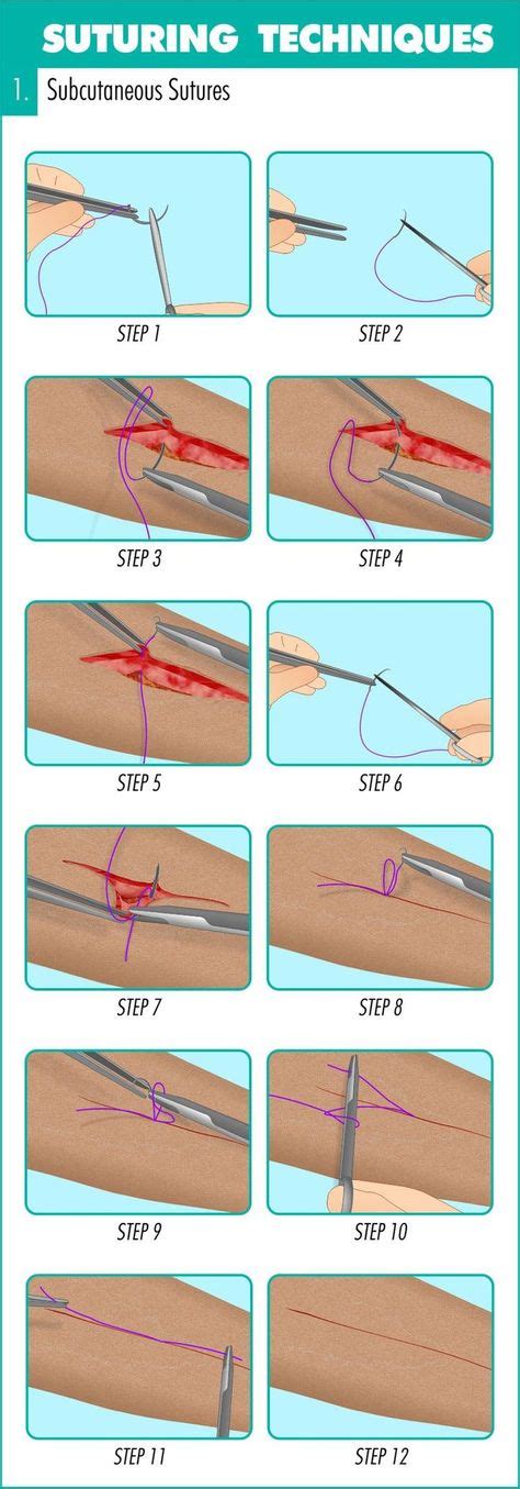 18 Suture Techniques ideas | suture techniques, sutures, surgical tech