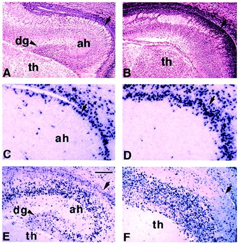 Control Of Hippocampal Morphogenesis And Neuronal Differentiation By