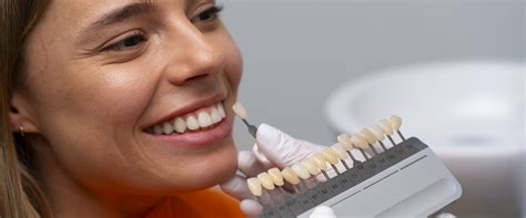 Faccette Dentali Cosa Sono Studio Dentistico Sannicolo