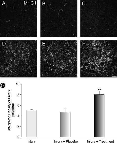 The Mhc Class I Immunolabeling In The Spinal Cord Ventral Horn Of