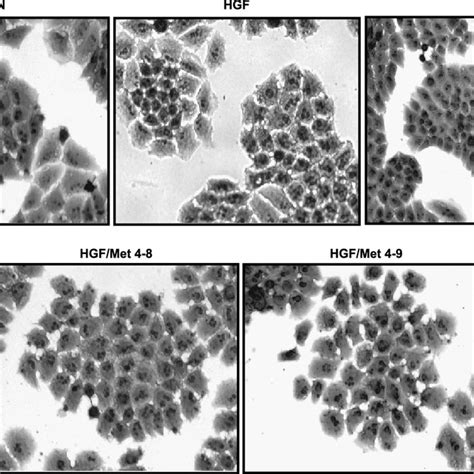 Figure W2 Expression Of E Cadherin In High HHGF Metexpressing Cells