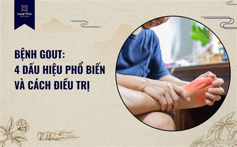 BỆnh Gout 4 DẤu HiỆu PhỔ BiẾn VÀ CÁch ĐiỀu TrỊ Lang Tĩnh