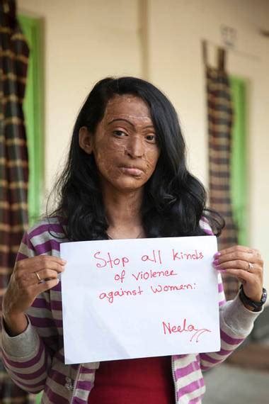 approachingsignificance: Acid attack survivors... | We Speak For Earth