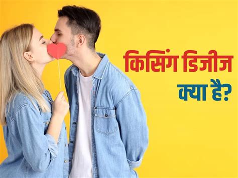 Kiss करने से भी फैलती है ये बीमारी जानिए किसिंग डिजीज के लक्षण