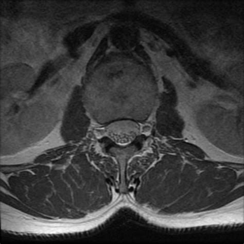 Mri Doccheck