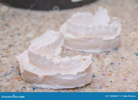 Plaster Impression of Teeth. Dental Plaster Mold Stock Image - Image of ...