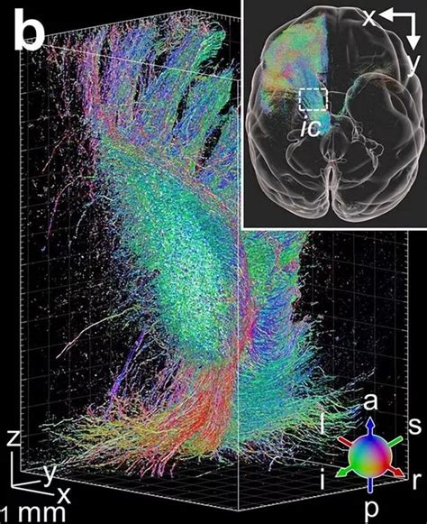 Scientists could unlock secrets of human brain with first high-res ...