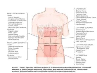 Abdominal mass | PPT