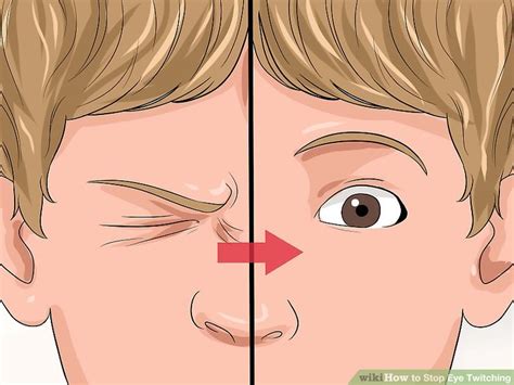 Doctor-Approved Advice on How to Stop Eye Twitching - wikiHow