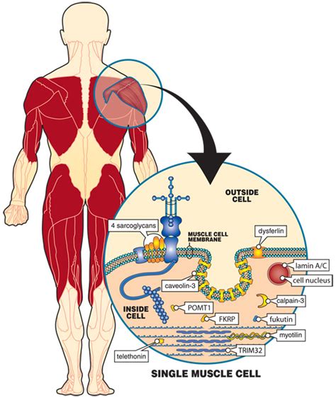 Muscular Dystrophies Limb Girdle