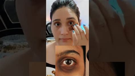 1 ही रात मे आंखों के काले घेरे हटाने के घरेलू नुस्खे Dark Circles