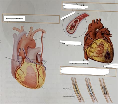 Versorgung Des Herzens Diagram Quizlet