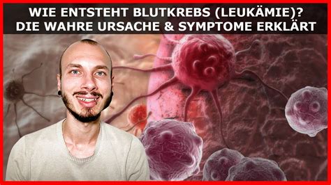 Wie entsteht BLUTKREBS LEUKÄMIE WAHRE Ursache und Symptome