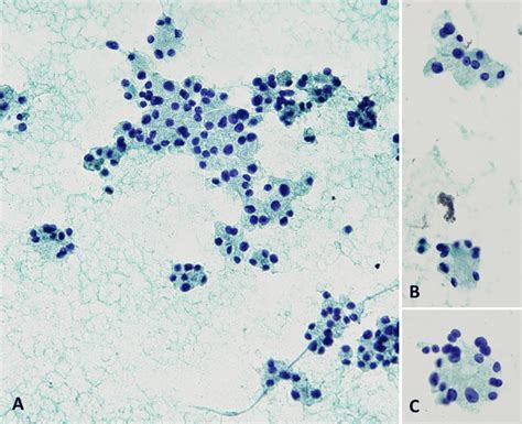 Fine Needle Aspiration Cytology First Study A Groups And